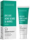 DERMATOUCH Bye Bye Acne Scars & Marks Cream || Acne Spots and Scars Corrector || Formulated Specially to Address Scars & Marks || Gives Even Skin Tone || Suitable For All Skin Types - 30 G